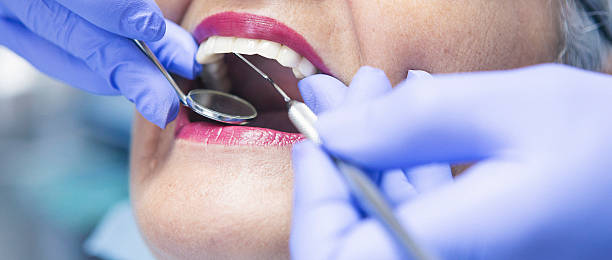 Teeth Whitening in AR